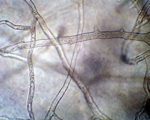 Aseptate Hyphae