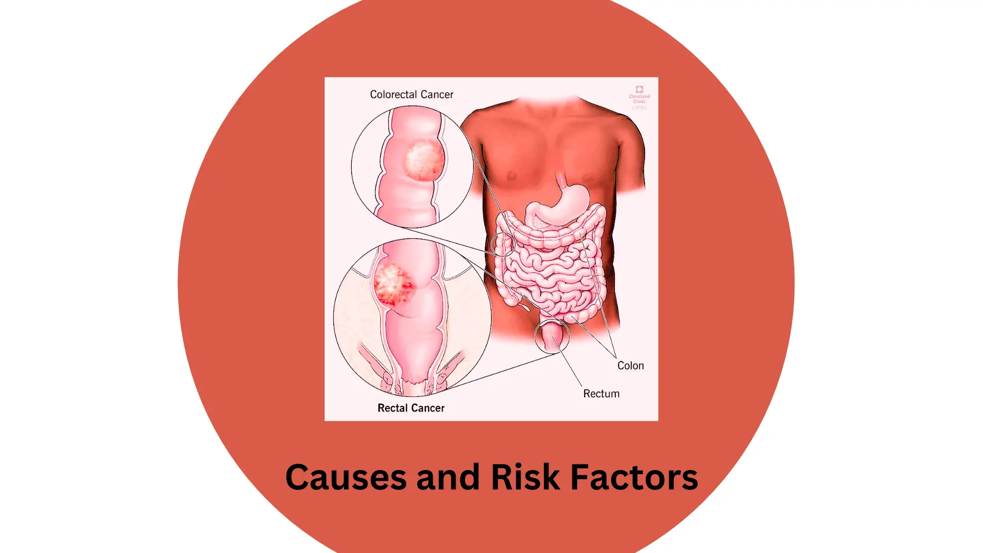 Causes-and-Risk-Factors.