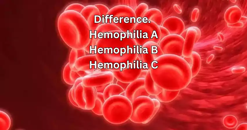 Difference Between Hemophilia A and B and C