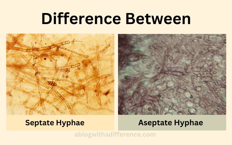 Septate and Aseptate Hyphae