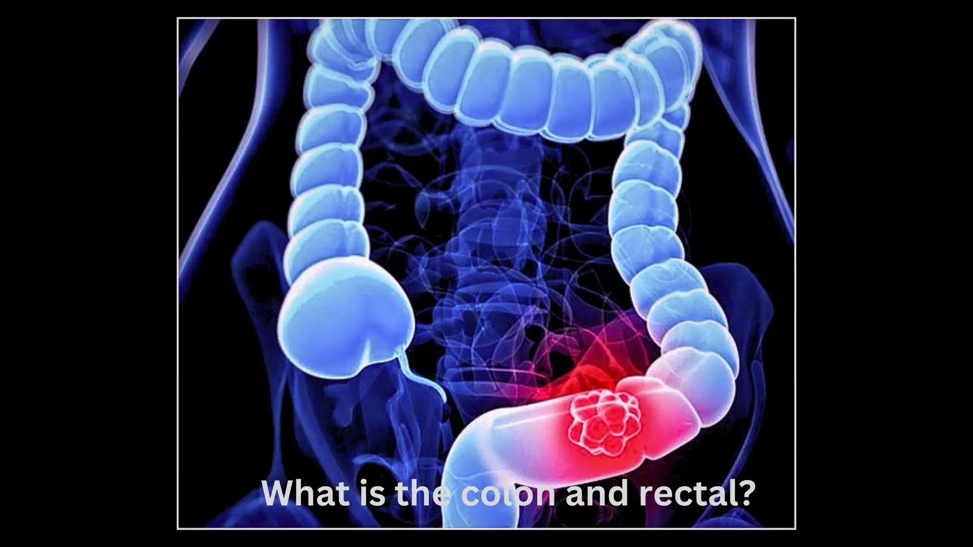 What-is-the-colon-and-rectal
