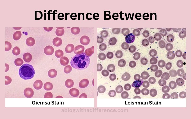 Giemsa Stain and Leishman Stain