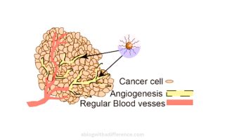 Angiogenesis