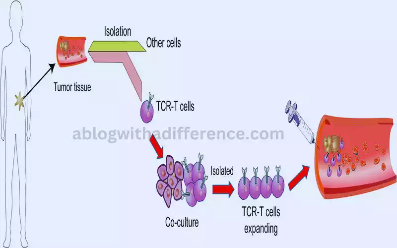 Definition of TCR-T cell therapy