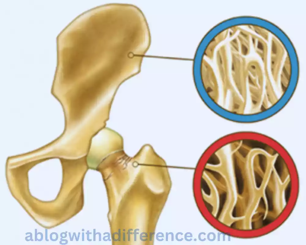 What is Bone Deposition?