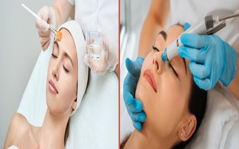 10 Cult-Favorite Difference Between Dermabrasion and Chemical Peel Products You Should Know