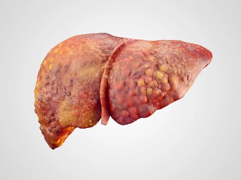 Hepatocellular 