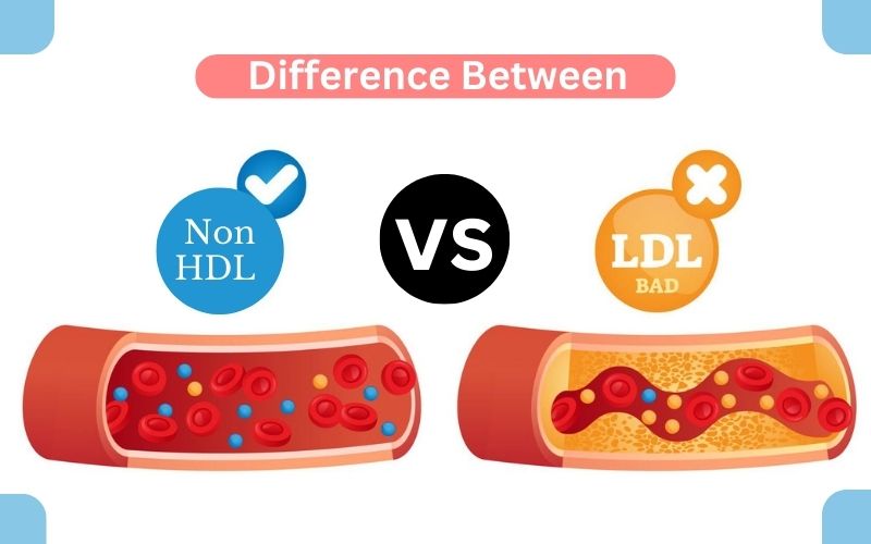 Non-HDL Cholesterol and LDL Cholesterol