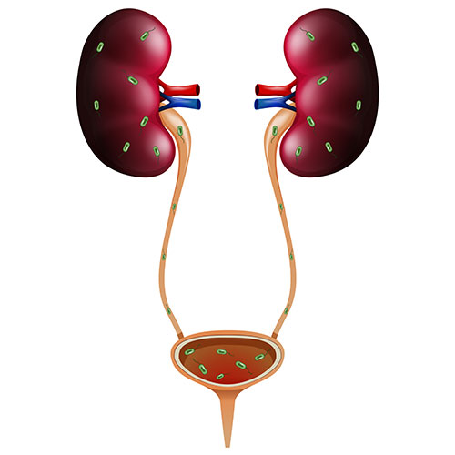 Prolapsed Bladder