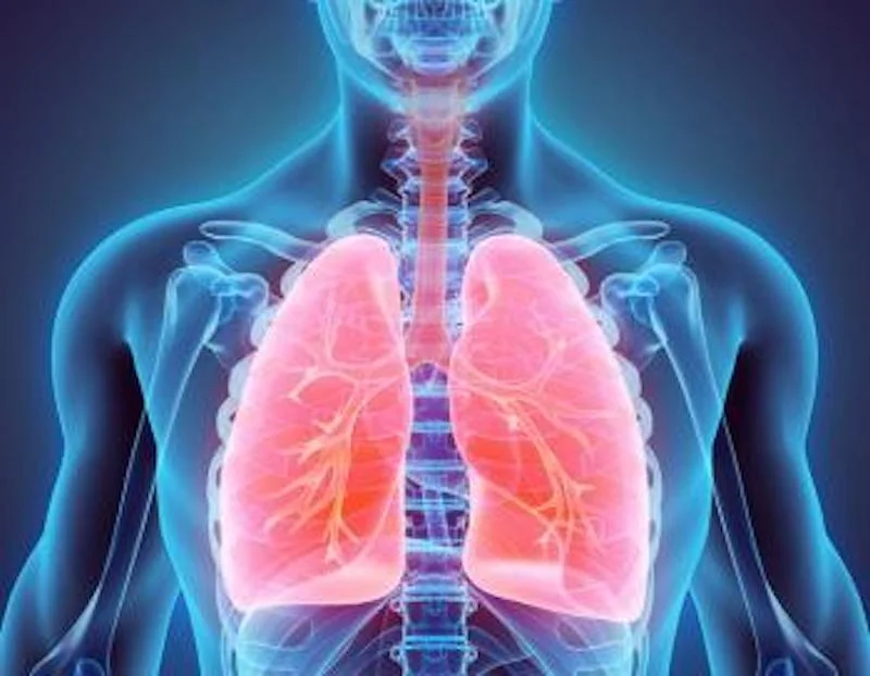 Cardiogenic Pulmonary Edema