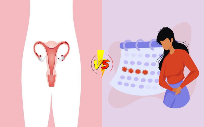 15 Thing Every Girls Should know about  Difference Between Ovulation and Menstruation
