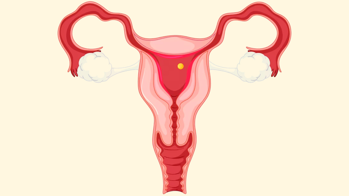  Ovulation and Menstruation