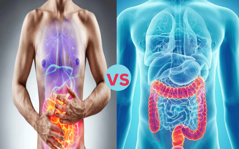 10 Ways Difference Between Colitis and Proctitis Can Help You Live long time