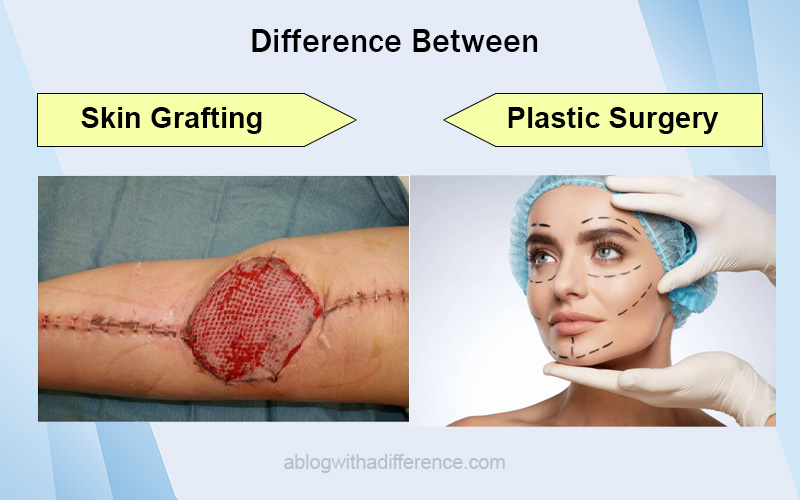 Difference Between Skin Grafting and Plastic Surgery